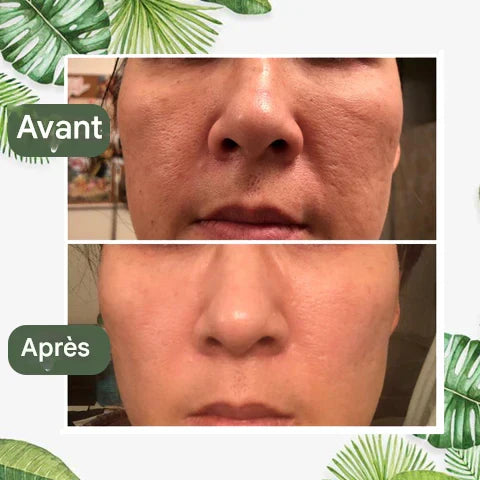 Diystar™ Masque Nettoyant en Profondeur au Thé Vert 100% Naturel
