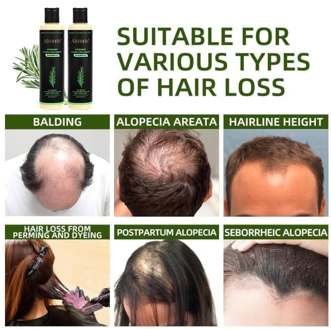🔥LAST DAY 50% OFF - Alisanda® Organic Rosemary Hair Growth Shampoo